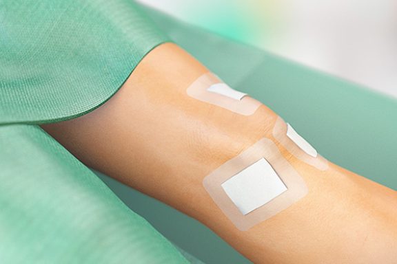 Sorbact-förband över knä efter artroskopi.